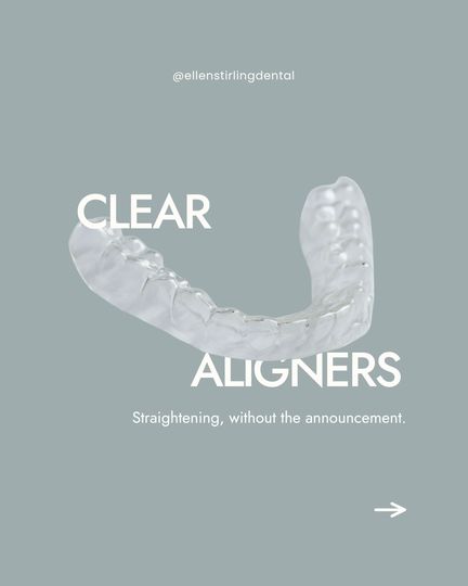 Classy Minimalist clear aligners post