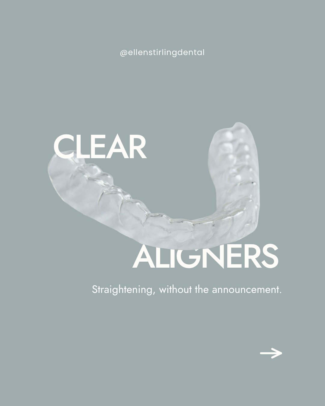Classy Minimalist clear aligners post