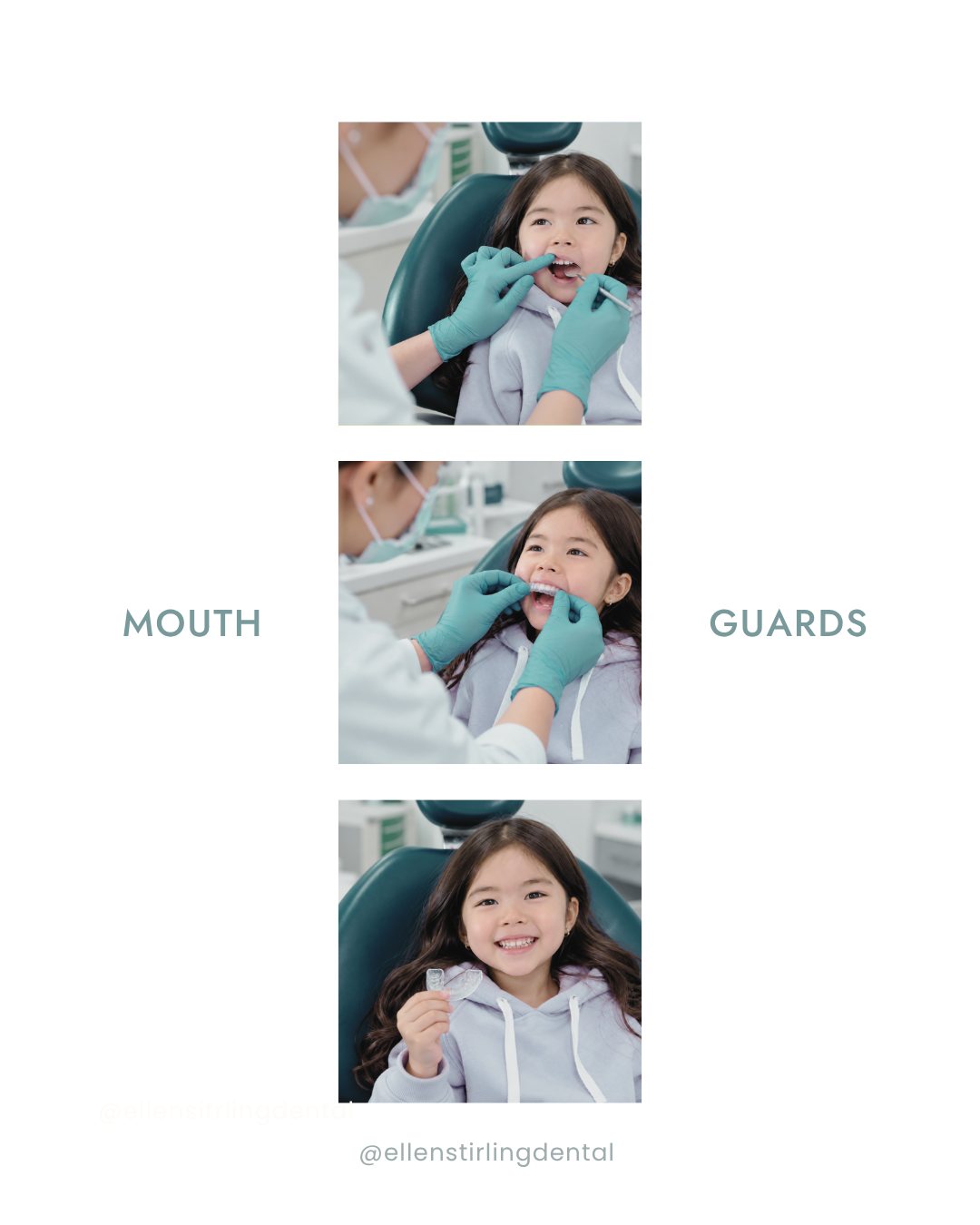 Classy Minimalist mouth guards post