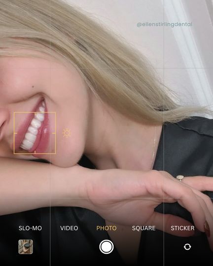 Classy Minimalist smile detail post