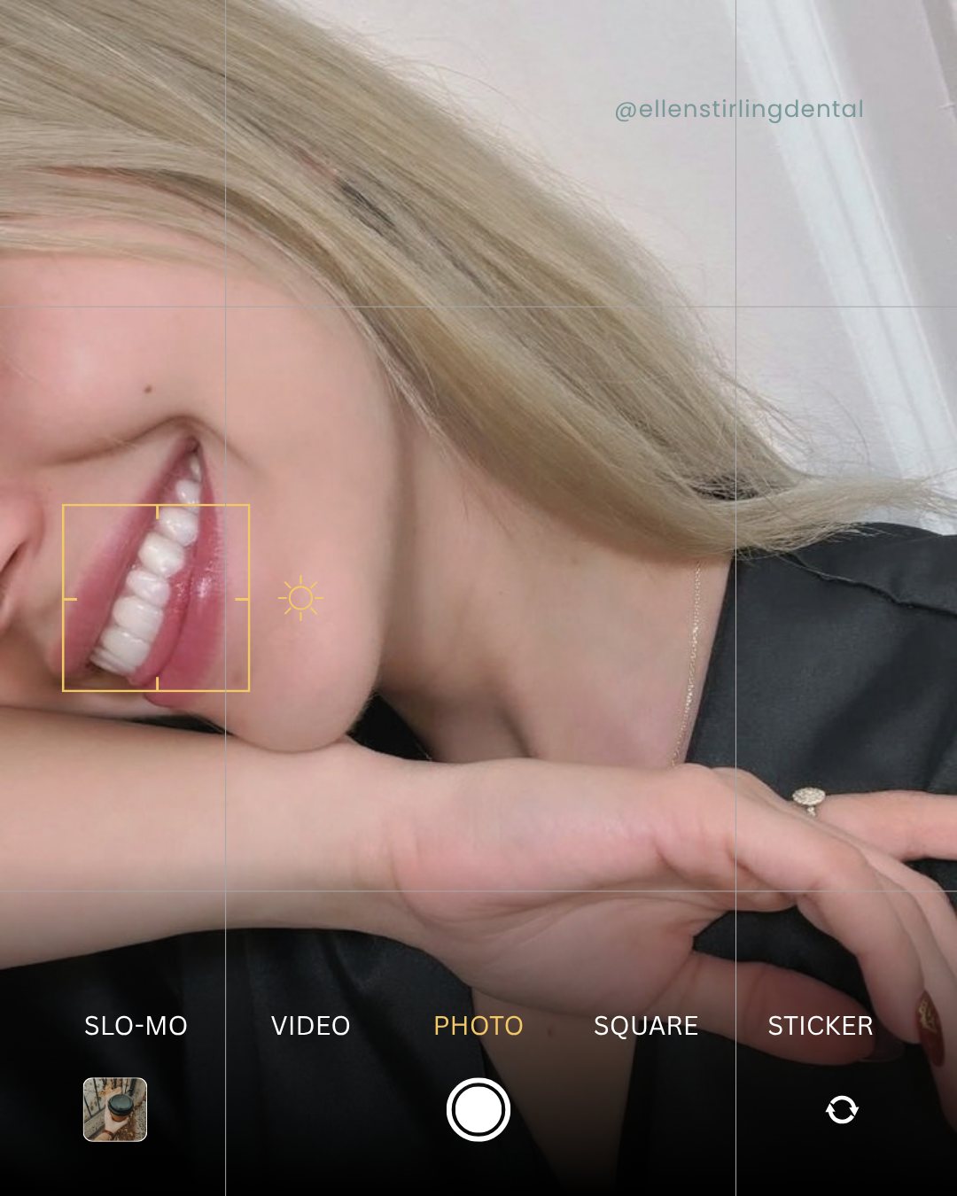 Classy Minimalist smile detail post